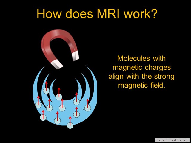 MRI Explained_2 3