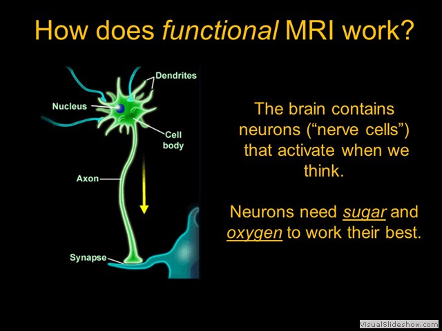 MRI Explained_2 6