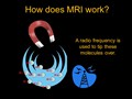 MRI Explained_2 4