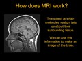 MRI Explained_2 5