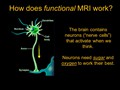 MRI Explained_2 6