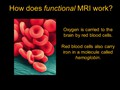 MRI Explained_2 7